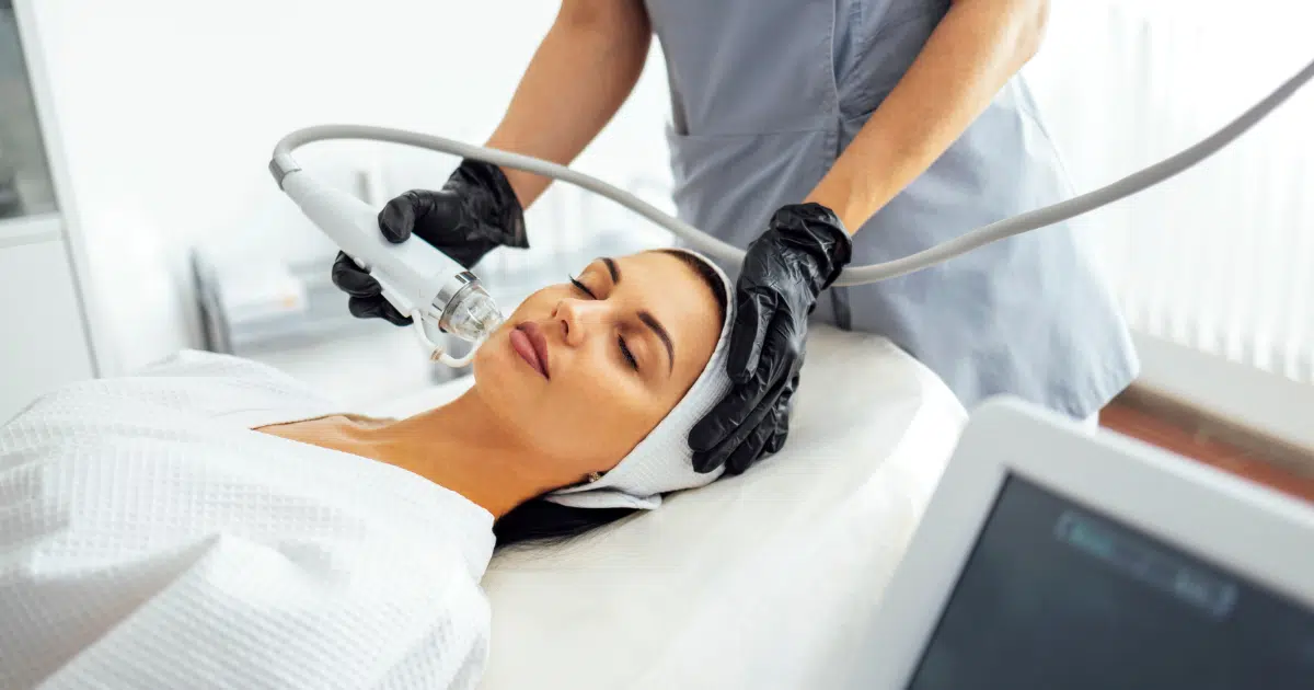 A woman undergoing vivace rf microneedling
