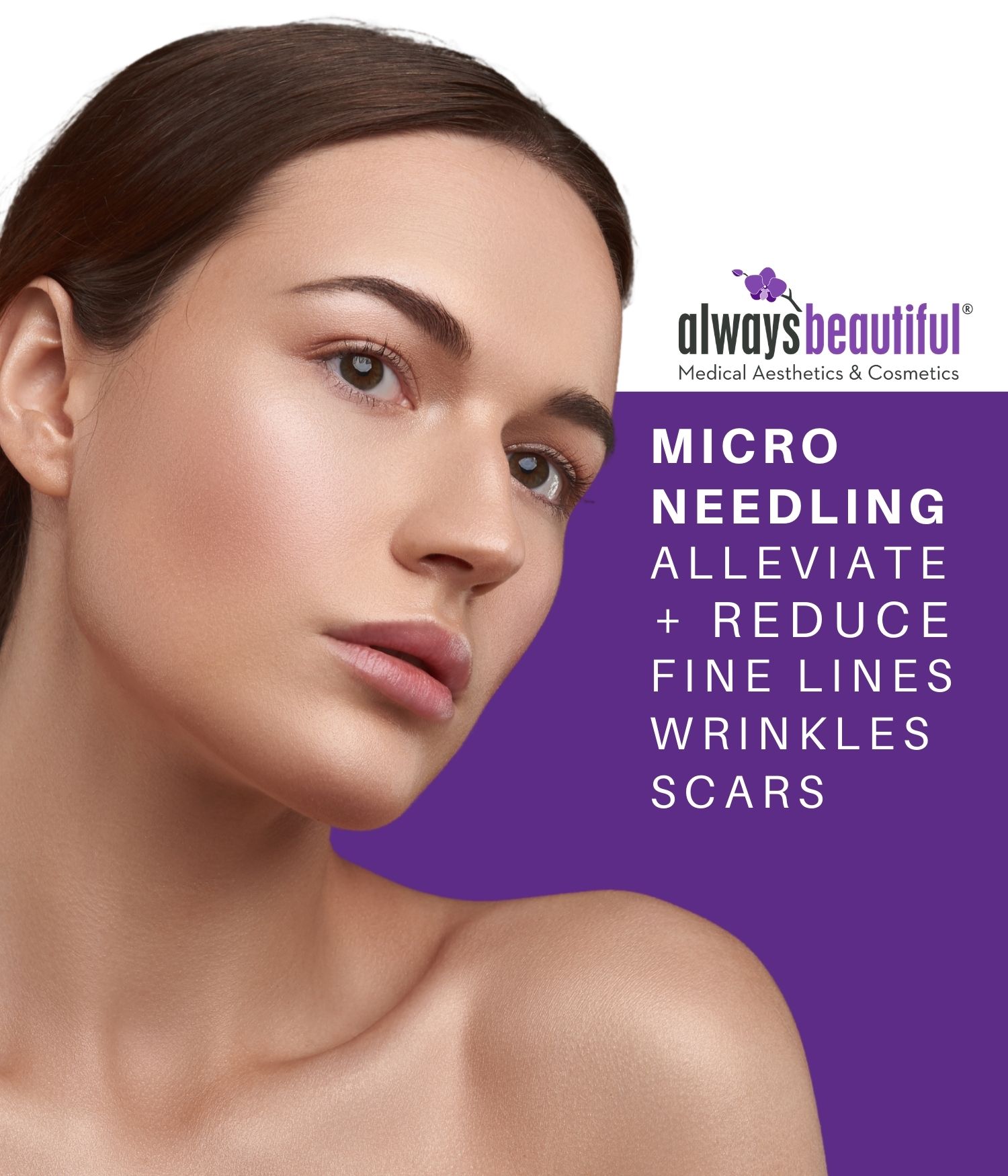 Woman with reduced fine lines and wrinkles after microneedling treatment at Always Beautiful.