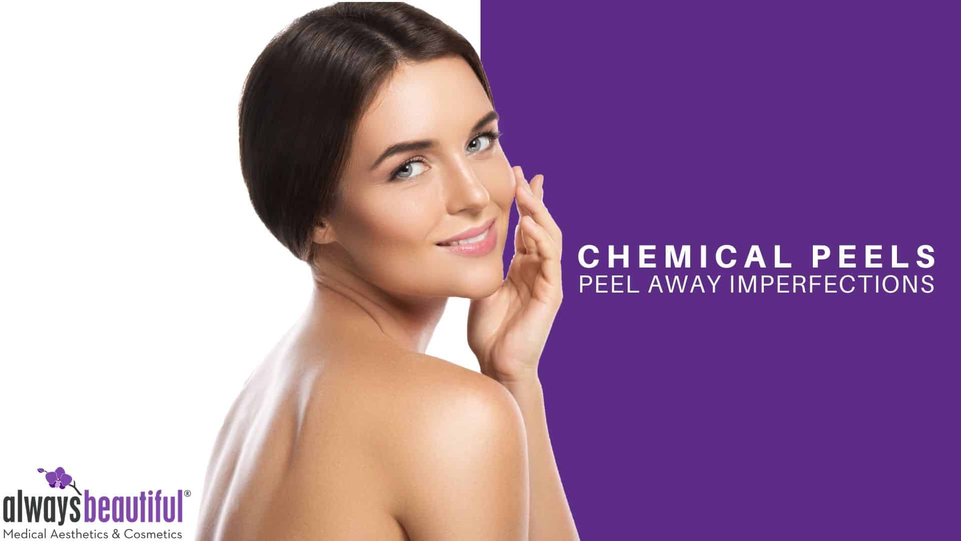 chemical peels always beautiful