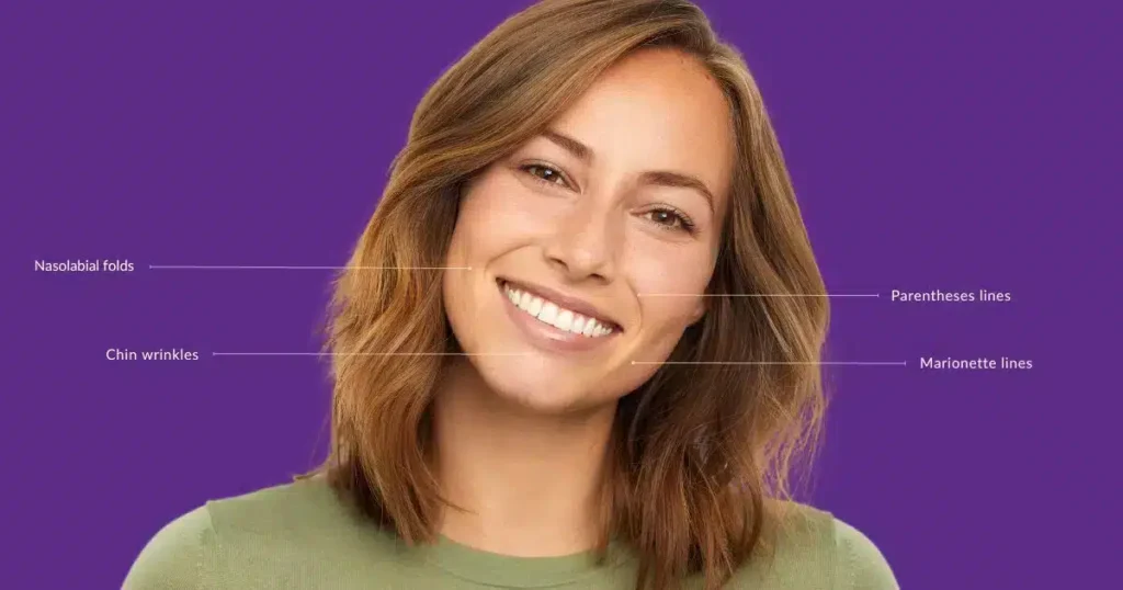 Sculptra treatment areas Always Beautiful Medspa Aurora CO.jpg Sculptra treatment areas Always Beautiful Medspa Aurora CO.jpg